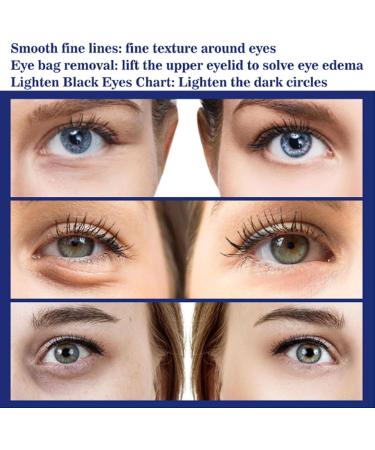 Glozie Instant Eye Lift Glozie Eye Instant Eye Bag Eraser Glozie Eye Cream Glozie Eye Bag Remover Instant Eye Lift Smooth Wrinkles Tighten Sagging Skin & Brighten Skin Tone /344 ( Color - Buy Online on GoSupps.com