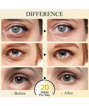 24K Gold Under Eye Patches - Gel Eye Mask for Dark Circles Puffy Eyes Bags & Wrinkles | Hyaluronic Acid & Collagen | Eye Treatment for Men & Women - Buy Online on GoSupps.com