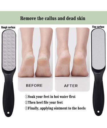 Foot Scrubber - Callus Remover Durable Scrubber Dead Skin Remover Hygienic Pedicure Tool Professional Grater Rasp Foot Scraper Corns Callous Removers Cracked Dead Skin Remover - Buy Online on GoSupps.com
