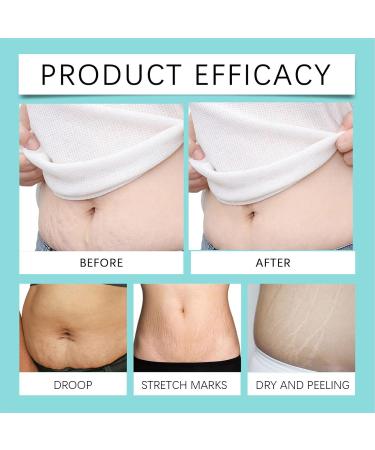 Pregnancy Body Oil 32ml Skin Firming And Tightening Body Oil - Scar Repairing Oil For Maternity Pregnancy For Growing Areas Scars Stretchmarks - Buy Online on GoSupps.com