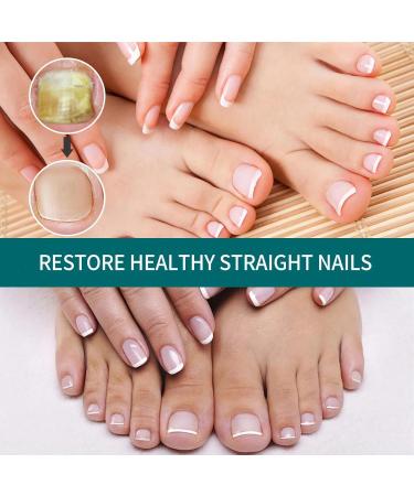 Nail Fungus Serum For Toenail-Natural Anti Fungal Treatment Extra Strong Repair Essence Fungal Nail Polish For Finger & Toe Nails - Buy Online on GoSupps.com