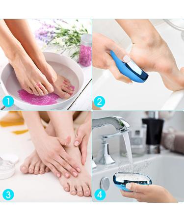 Nano Glass Corneal Remover - 2 in 1 Wet & Dry Cornea Plane for Safe & Effective Foot Care | High Gloss Blue - Buy Online on GoSupps.com