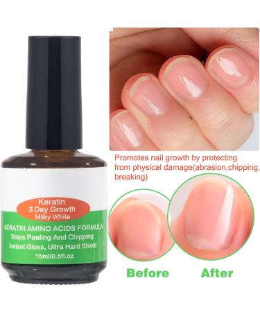 ASMAYSA Keratin 3 Day Growth Nail Treatment - Nail Strengthener and Nail Growth - Fast Keratin Nail Hardener & Nail Strengthener for Thin Nails Brittle & Damaged Maximum Strength Formula 15ml 3 Days Nail Growth - Buy Online on GoSupps.com