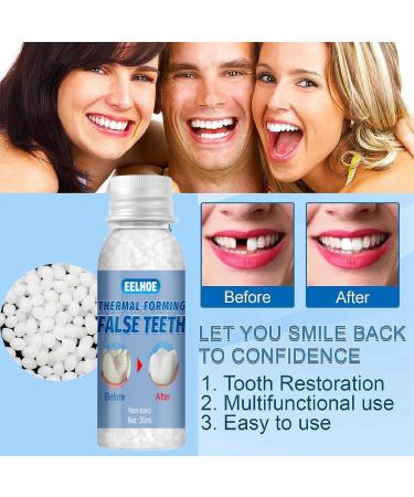 Temporary Tooth Repair Kit | Dental Tools for Instant Tooth Filling | False Teeth Replacement Beads - Buy Online on GoSupps.com