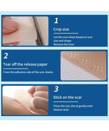 Silicone Scar Sheets for Treatment & Removal - Reusable, Professional Grade - C-Section, Surgery, Acne, Keloid - 1.6x6 (4 Pack) - Buy Online on GoSupps.com