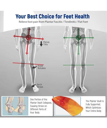 High Support Arch Orthopedic Insoles | Relief for Plantar Fasciitis Flat Feet & Heel Pain | EU Sizes 36-41 | Shock-Damping Inserts for Men & Women - Buy Online on GoSupps.com