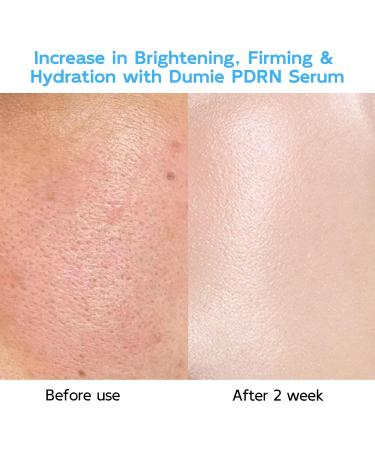 Salmon DNA PDRN Anti-Aging Serum 5000ppm Salmon Egg DNA Ampoule 2000ppm Collagen Glutathione Niacinamide & 6 Hyaluronic Acids Korean Skincare for Wrinkles & Radiance,0.05 fl.oz x 30e - Buy Online on GoSupps.com