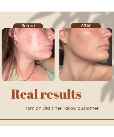 Organic Tallow Face Moisturizer - 4oz - 100% Grass Fed Beef Tallow For Skin Care - Made in the USA - Whipped Tallow Balm - Hydrating Salve - Natural Lotion - Ancestral Skincare - Amber Glass - Vanilla - Buy Online on GoSupps.com