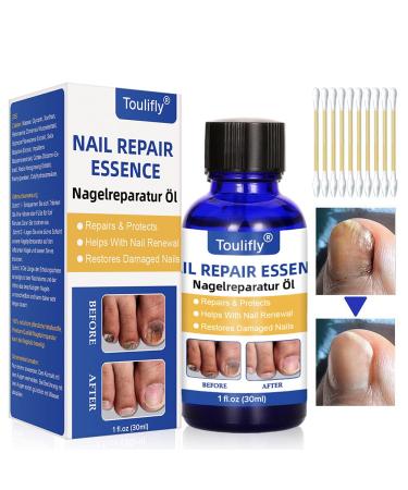 Nail Repair, Fingernail and Toenail Repair, Maximum Strength Nail Solution, Repairs and Protects Toenail and Fingernail from Discoloration, Brittle and Crack 1 Fl Oz (Pack of 1)
