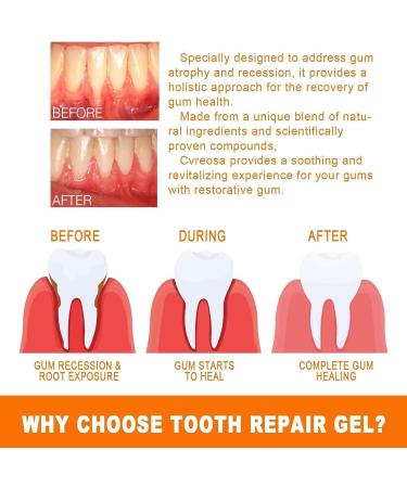 Oral & Gum Repair Treatment Ampoules - Deep Clean Teeth Remove Yellow Stains & Tartar | 1 Box - Buy Online on GoSupps.com