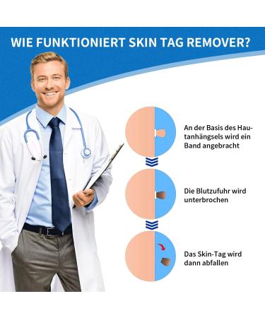 Fast & Painless Wart Remover Kit - 2 in 1 Skin Tag Remover for 2mm-8mm | Effective International Shipping - Buy Online on GoSupps.com