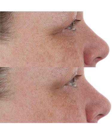 High Potency Retinol Recovery Overnight Moisturizer 2 Fl Oz - Hydrating Anti-Aging Treatment - Buy Online on GoSupps.com