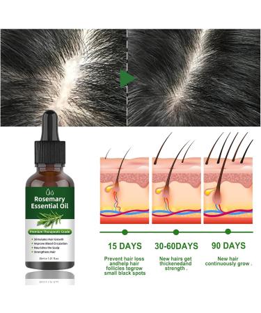 Rosemary Oil for Hair Growth Rosemary Oil for Hair Hair Oil Nourishes the Scalp Hair Strengthening Oil for Fuller Healthier Hair Essential Skin Face Care Eyebrow and Eyelash Growth 100% - Buy Online on GoSupps.com