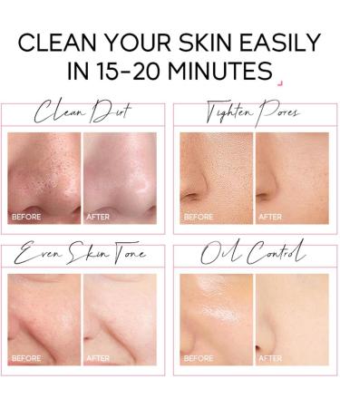  G n rique 50G Peel-Off Mask - Deep Cleansing and Oil Control | Hydrating Facial Mask with Cherry Blossom Extract | Pore Cleansing Impurity Removal and Quick Treatment - Buy Online on GoSupps.com