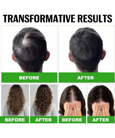 Raw Batana Oil: 100% Batana Oil for Hair Growth Pure Natural Batana Oil Unrefined - Prevent Hair Loss and Promotes Hair thickness for Women & Men (4.2fl.oz/120g) - Buy Online on GoSupps.com