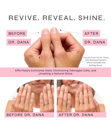 Dr. Dana Nail Buffing Block Set - Smooth Shine & File Natural Nails | 3 Sided Grit + Replacement Grits | Perfect for Fingernail & Toe Care - Buy Online on GoSupps.com