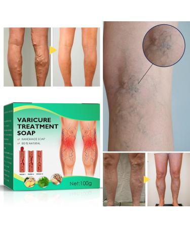  Katutude Veinopro Varicose Veins Treatment Soaps for Legs and All Skin Types (2 Pack) - Buy Online on GoSupps.com