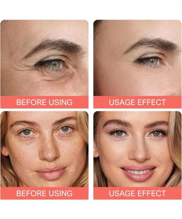 Multi Effect Hydrating Serum - Vitamin C Serum For Face Anti Aging Face Serum Niacinamide & Hyaluronic Acid Serum Evens Skin Tone And Hydrating Dark Spot Corrector Pore Remover - Buy Online on GoSupps.com