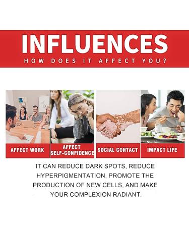 Dark Spot Remover for Face and Body Freckle Removel Cream Pigmentation Removal Melasma Cream Dark Spot Corrector Dark Spot Remover for Face Age Spot Remover for Face Dark Age Spot Remover - Buy Online on GoSupps.com