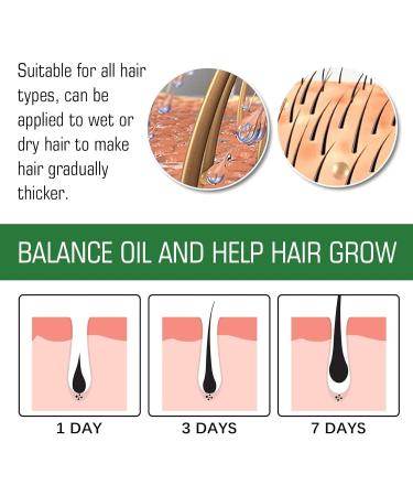 60ml Hair Growth Serum Women Hair Growth Essential Oil Natural Hair Growth Spray Hair Growth Oil for Hair Loss Hair Loss Treatment for Women Hair Serum for Dry Damaged Hair Hair Oil for Hair Growth - Buy Online on GoSupps.com
