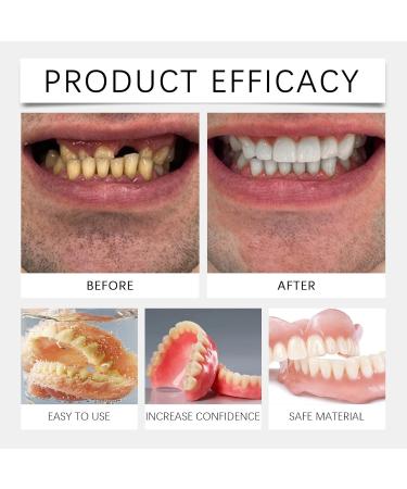 Rapid Smile Denture Reline Set - Upper and Lower Dentures Set Rapid Smile Moldable False Teeth Fast to Install Durable Fit 2025 Easy to Use - Buy Online on GoSupps.com