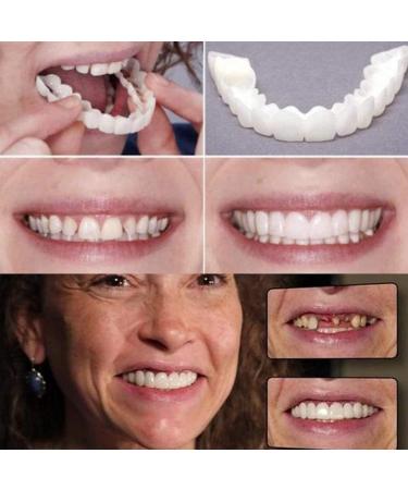 Cosmetic Snap-On Teeth Veneers | Perfect Smile | 2 Pairs - Top & Bottom Artificial Teeth - Buy Online on GoSupps.com