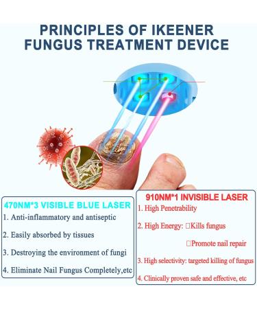 iKeener Nail Fungus Light Treatment Device For Toenail Toe Nail Fungus Treatment Extra Strength With 407nm Blue Light&905nm Light For Nail Fungus& Onychomycosis Fingernail Fungus Removal At Home HZJ-01 - Buy Online on GoSupps.com