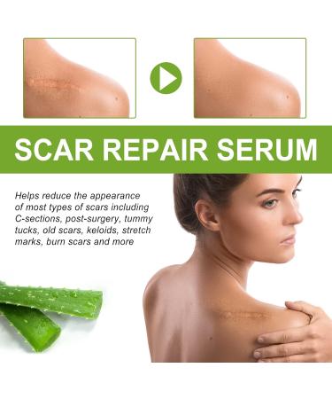 MCTEST Scar Repair Serum - Natural Ingredients with Vitamin E - Reduce Scars in All Skin Types - 30ml - Buy Online on GoSupps.com