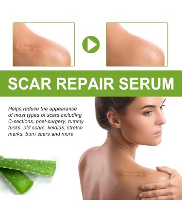 Goopgen Advanced Scar Repair Serum - Medical Grade Treatment for All Types of Scars (30ml 2pcs) - Buy Online on GoSupps.com