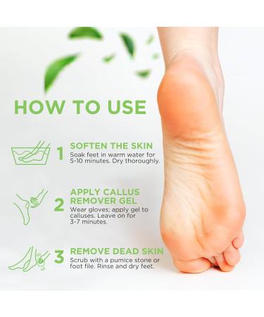 Foot Callus Remover Gel Set - Professional Feet Care for Smooth Skin & Cracked Heels - 8oz Made in USA with Pumice Stone - Buy Online on GoSupps.com