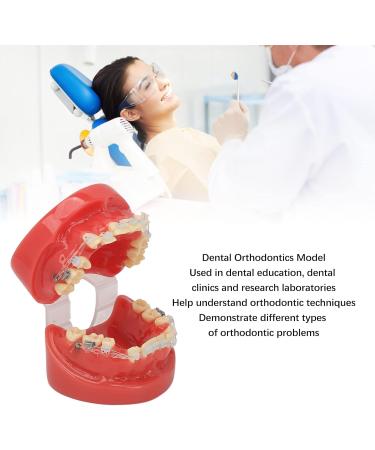 Orthodontic Ceramic Demonstration Model - 24 Teeth with Wires & Bracket for Overcrowding Painting & Jaw Opening - Buy Online on GoSupps.com