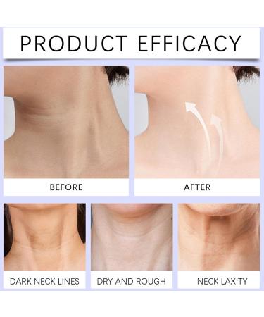 Neck Firming Cream Neck Tightening Cream Tighten and Lift Neck Cream Anti-Aging Neck Cream for Tightening and Wrinkles Advanced Tightening Moisturizer for Firm Retinol Moisturizer Cream for Women - Buy Online on GoSupps.com