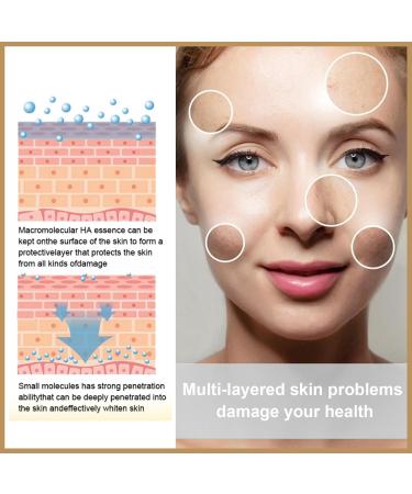 Komsoup Moisturizing Face Toner Rice Toner Vegan Moisturizing Rice Toner Beauty Toners Moisturizing Beauty Lotion Natural Moisturizer Rice Extracts-150 L - Buy Online on GoSupps.com