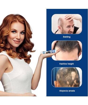 TUITUII Hair Growth Serum Hair Growth Serum Hair Lotion Hair Regrowth Lotion Hair Growth Care 20 g Hair Growth Serum Hair Growth Serum Hair Growth Serum Hair Growth Ointment - Buy Online on GoSupps.com