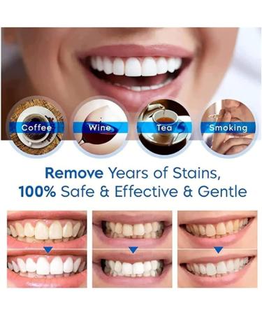 Buy Tlopa Ampoule Toothpaste & Serum - 3V Teeth Whitening Essence | Tartar & Stain Remover | 10 & 50 Pcs Available - International Shipping - Buy Online on GoSupps.com