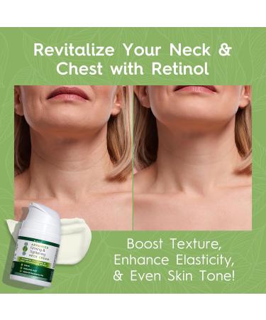 Tree to Tub Neck Firming Cream - Hydrating Neck & Chest Cream with Hyaluronic Acid & Retinol for Wrinkle Reduction | Advanced Firming Solution for Women & Men - Buy Online on GoSupps.com