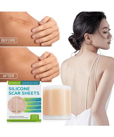 Teksome Scar Tape for Body - 1.5m Stretch Mark Remover Strips | Silicone Gel Tape for Scars & Stretch Marks - Buy Online on GoSupps.com