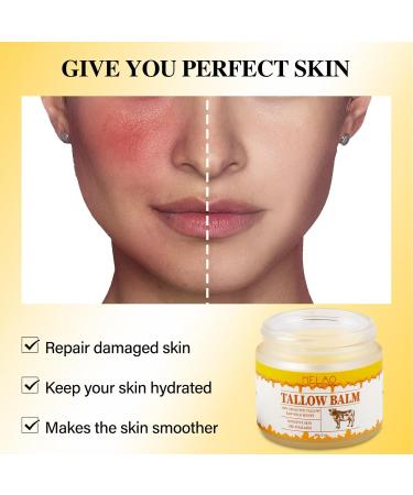 Natural Beef Tallow Cream - Nourishing Body Lotion for Sensitive Skin | Grass Fed Non-Greasy Moisturizer with Honey - International Shipping Available - Buy Online on GoSupps.com