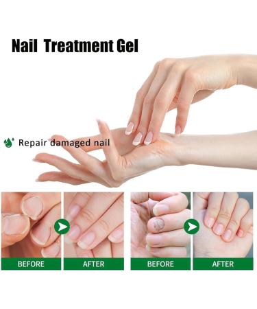  Raypontia Nail Cream - 20ml Intensive Strengthening Gel for Nails Moisturizing Care for Dry and Cracked Nails Men and Women Nighttime Use Shower Travel Home Sports - Buy Online on GoSupps.com