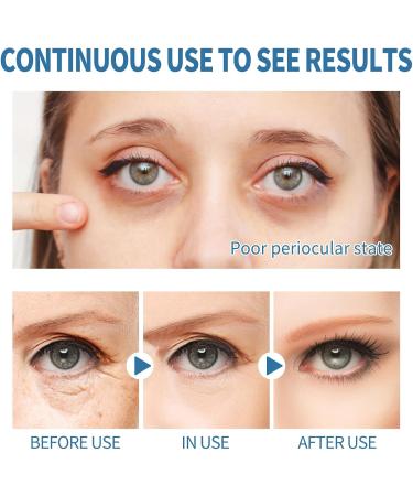 Marine Collagen Eye Bags Treatment Anti Aging Eye Mask Patches Marine Collagen Eye Gel Eye Gel Pads Under Eye Mask Gel Pads Eye Moisturizer Mask Eye Gel Pads for Puffy Eyes - Buy Online on GoSupps.com