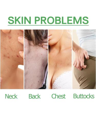 Trendyfave Dark Spot Correcting Glow Serum Skin Tag Removal Age Spot Remover For Face Scar Treatment Pore Minimizer Serums Skincare Contains Tea Tree Oil Vitamin E Body Acne Treatment 30ml - Buy Online on GoSupps.com