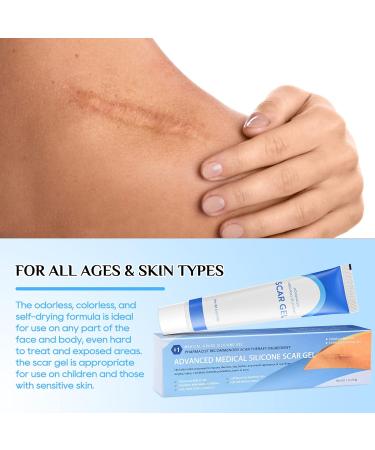 COSMTEK Silicone Scar Gel Cream - Physician Formulated for Keloids, C-Section, Burn, Surgery & Acne - 4cmx3m - Buy Online on GoSupps.com