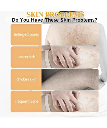 Orange Vitamin C Body Lotion Vitamin C Large-capacity 2 In 1 Face & Body Serum Body Moisturiser With Vitamin C Remove Dark Spots Body Lotion for Dry Skin Body Skin Care Smooth Skin 250ml - Buy Online on GoSupps.com