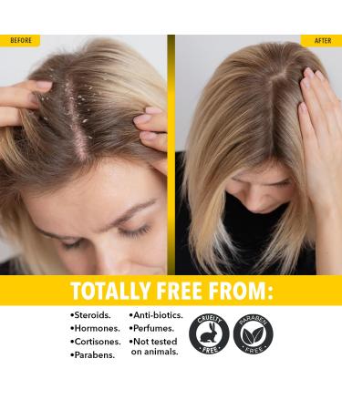 SULFUR BALSAM Conditioner - Natural Moisturizing & Detangling Hair Care (Pack of 3) - Gentle Scalp Treatment - International Shipping Available - Buy Online on GoSupps.com