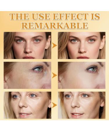 Boloshine Bee Venom AntiWrinkle Cream Bee Venom AntiWrinkle Firming Cream moisturizer antiaging face cream moisturizer for face and neck for all skin types 1 - Buy Online on GoSupps.com