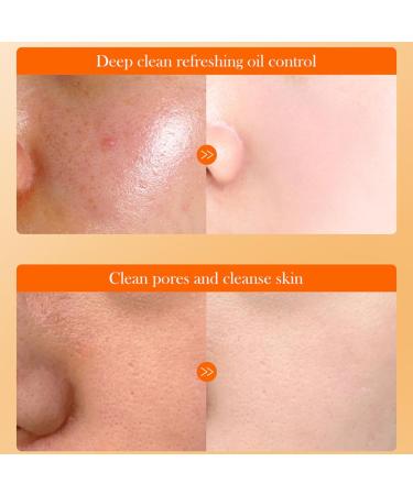  Ziennhu Micellar Water - Purifying Toner - Regulates Sebum Production - Moisturizing Face Cream - Nourishing Face Lotion - Moisturizing Lotion for Dry Skin - Anti-aging Face Lotion - Buy Online on GoSupps.com