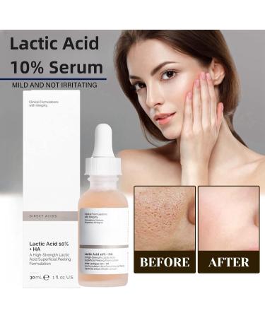 Lactic Acid 10% + Hialuronyc Acid 10% Exfoliating Serum 10% Lactic Acid Serum with Hyaluronic Acid Serum Lactic Acid Serum Face Serum for Women Hydrating Serum Brightening Serum Skincare 30ml - Buy Online on GoSupps.com