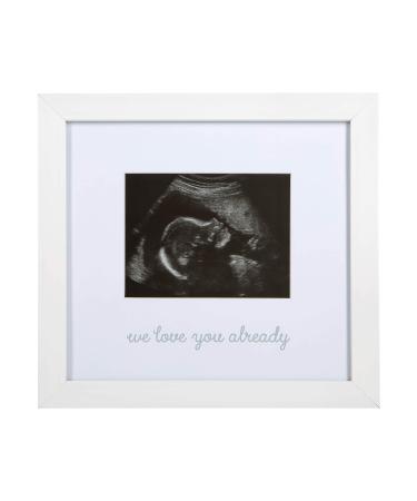 Kate & Milo Love at First Sight Ultrasound Picture Frame, Keepsake Sonogram Frame, Expecting Parent Gift, White Love at First Sight Sonogram Frame - Buy Online on GoSupps.com
