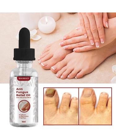 EUBEISAQI Toenail repair solution nail repair oil for damaged nails 10 ml nail softener care healthier extra strength nails renew damaged cracked ingrown toenail - Buy Online on GoSupps.com