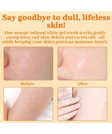 Facial Exfoliating Gel Deep Cleansing Moisturizing Exfoliator with Natural Plant Formula Skin Rejuvenation Orange Enzyme Purifying Scrub for Face & Body Suitable for All Skin Types - Buy Online on GoSupps.com